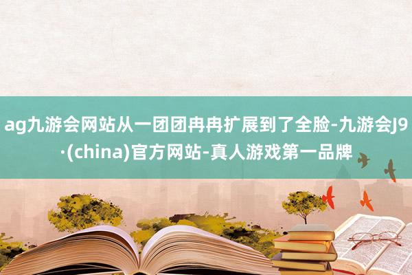 ag九游会网站从一团团冉冉扩展到了全脸-九游会J9·(chi